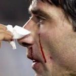 Superclasico