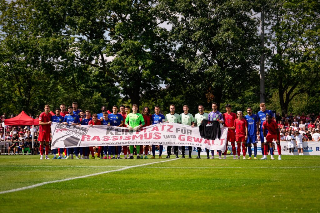 Il Bayern Monaco pareggia con una squadra di quarta divisione tedesca