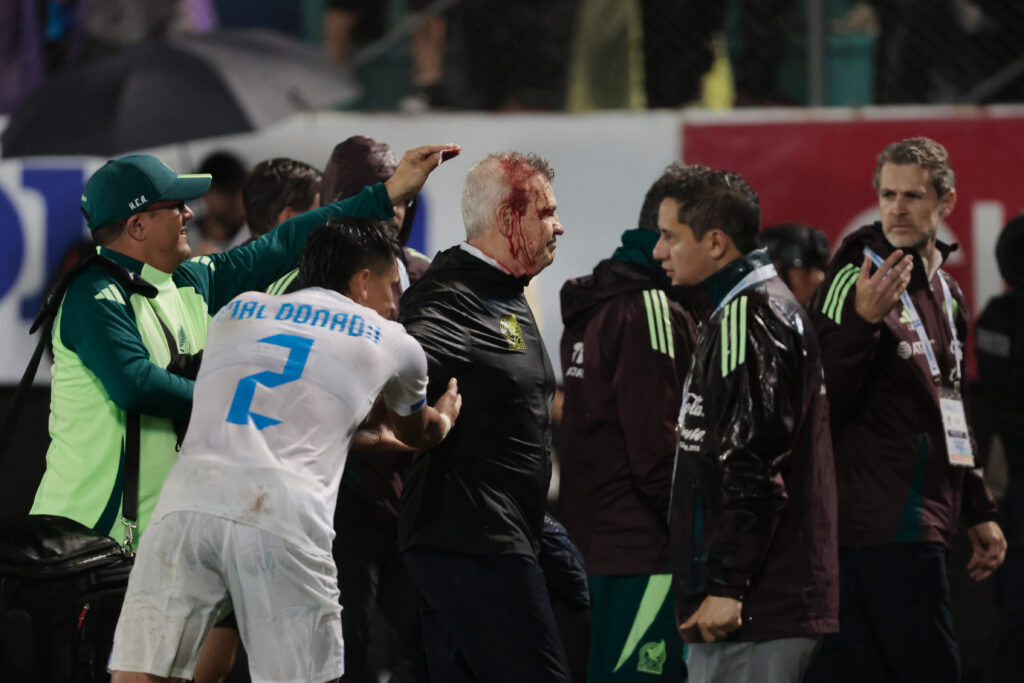 Aguirre CT del Messico